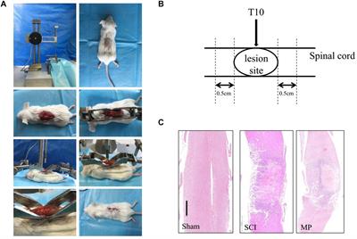 Methylprednisolone Induces Neuro-Protective Effects via the Inhibition of A1 Astrocyte Activation in Traumatic Spinal Cord Injury Mouse Models